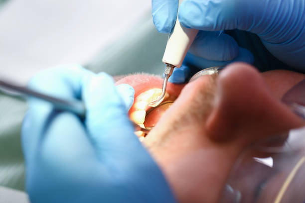 Best Emergency Treatment for Dental Infections or Abscesses in Mount Pleasant, PA